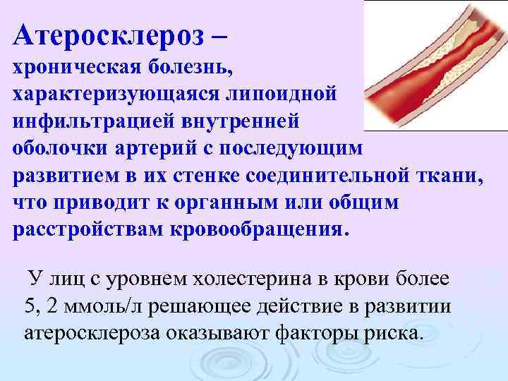 Атеросклероз – хроническая болезнь, характеризующаяся липоидной инфильтрацией внутренней оболочки артерий с последующим развитием в