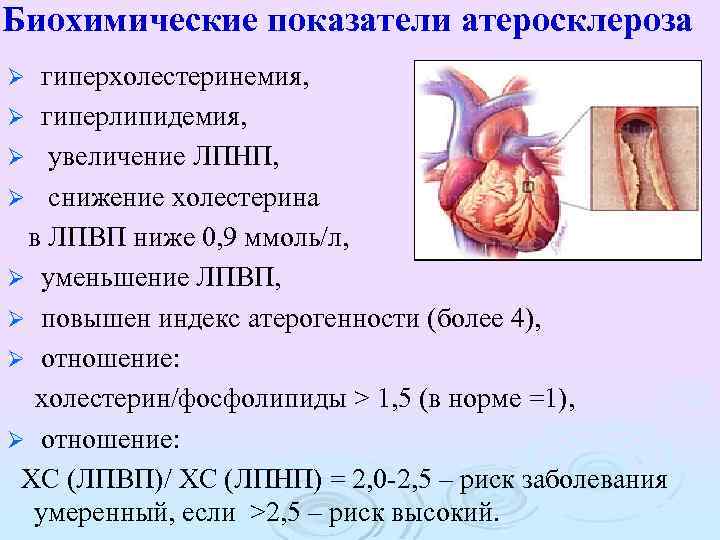 Биохимические показатели атеросклероза гиперхолестеринемия, Ø гиперлипидемия, Ø увеличение ЛПНП, Ø снижение холестерина в ЛПВП