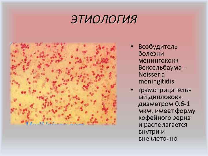ЭТИОЛОГИЯ • Возбудитель болезни менингококк Вексельбаума - Neisseria meningitidis • грамотрицательн ый диплококк диаметром