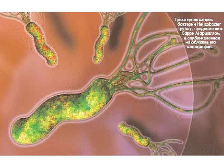 Успешное лечение инфекции H. pylori может увеличивать, уменьшать или не изменять секрецию соляной кислоты.
