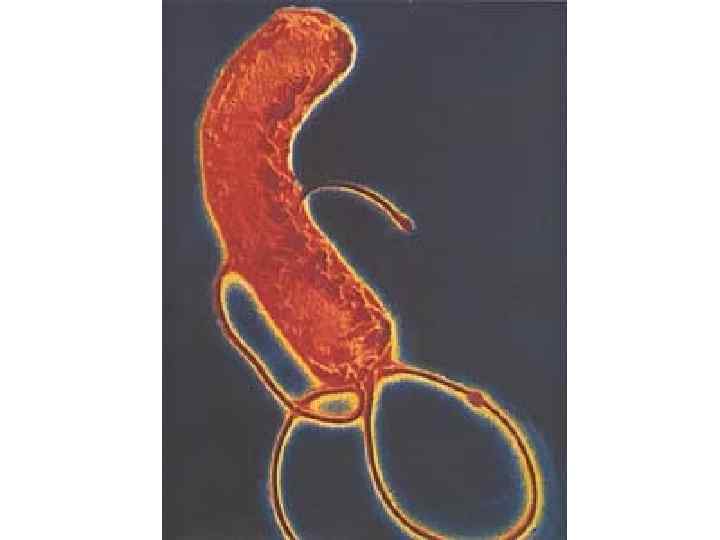 Нет H. pylori – нет язвы Warren & Marshall, 1983 