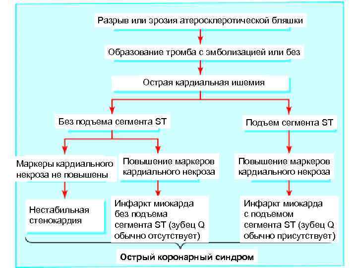 Разрыв или эрозия атеросклеротической бляшки Образование тромба с эмболизацией или без Острая кардиальная ишемия