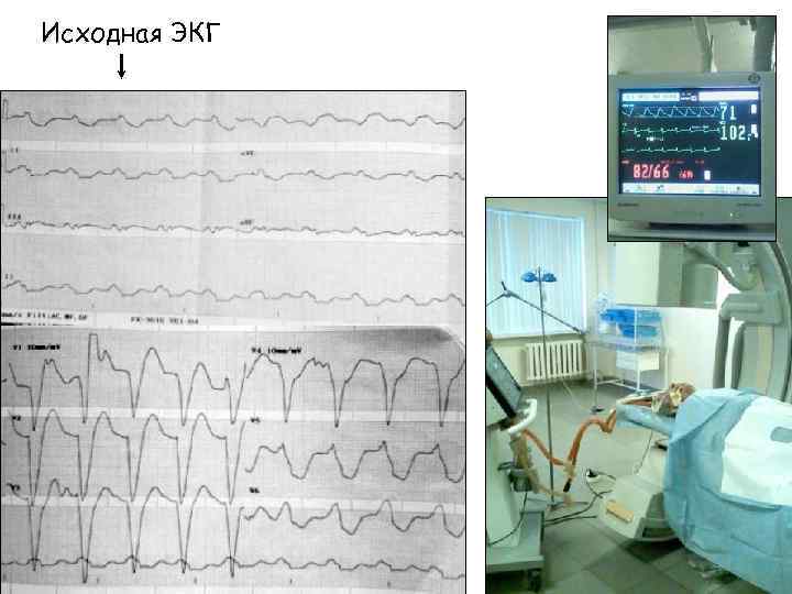 Исходная ЭКГ 
