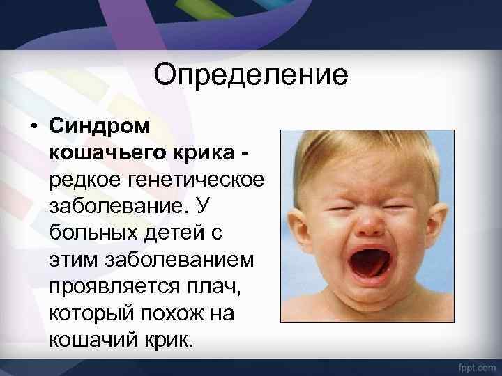 Презентация на тему синдром кошачьего крика