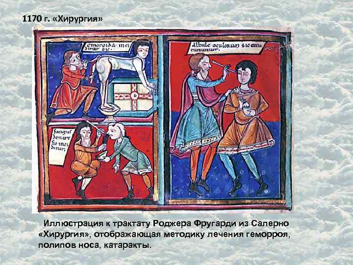1170 г. «Хирургия» Иллюстрация к трактату Роджера Фругарди из Салерно «Хирургия» , отображающая методику