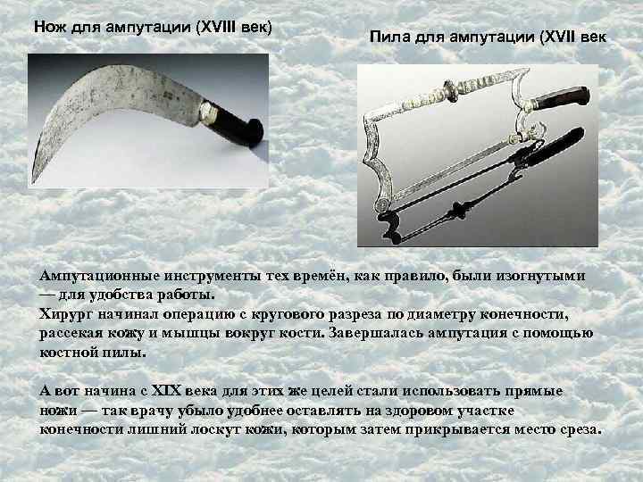 Нож для ампутации (XVIII век) Пила для ампутации (XVII век Ампутационные инструменты тех времён,