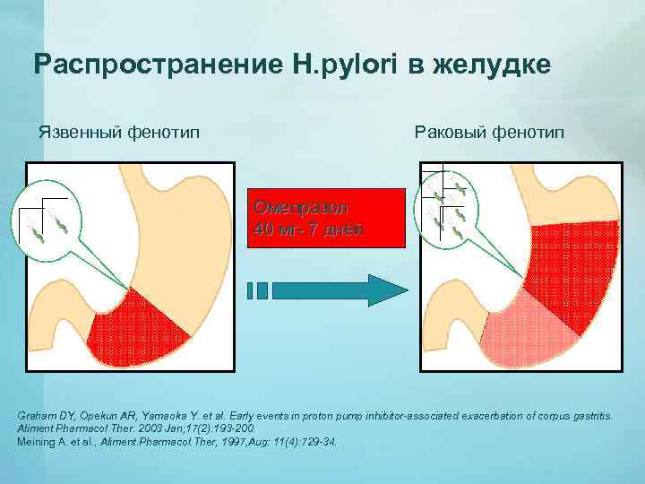 Распространение Н. pylori в желудке Язвенный фенотип Раковый фенотип Омепразол 40 мг- 7 дней