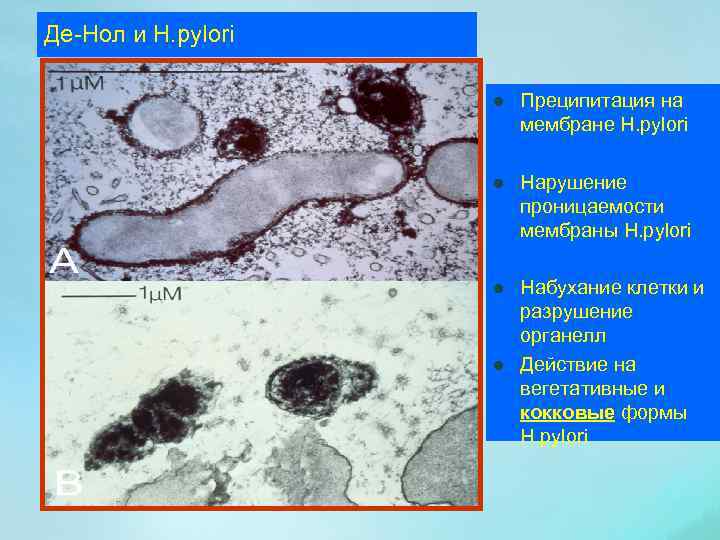 Де-Нол и Н. pylori l Преципитация на мембране H. pylori l Нарушение проницаемости мембраны