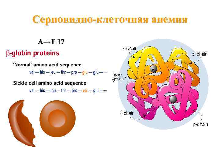 Серповидно клеточная анемия