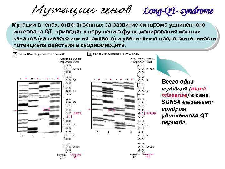  Мутации генов Long-QT- syndrome Мутации в генах, ответственных за развитие синдрома удлиненного интервала