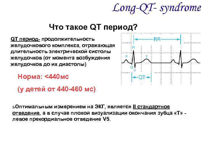  Определение Long-QT- syndrome Что такое QT период? QT период- продолжительность желудочкового комплекса, отражающая