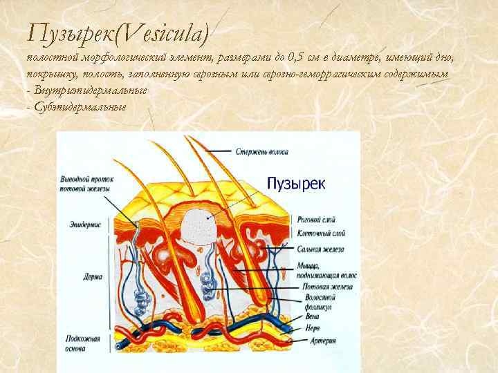 Пузырек(Vesicula) полостной морфологический элемент, размерами до 0, 5 см в диаметре, имеющий дно, покрышку,