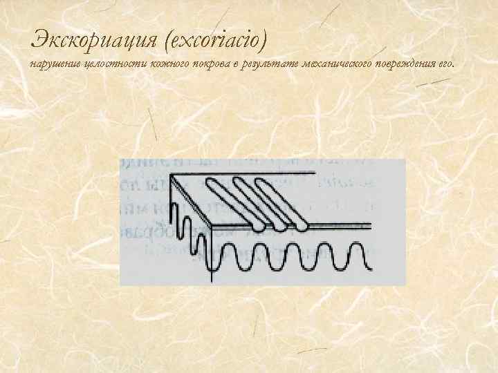 Экскориация (excoriacio) нарушение целостности кожного покрова в результате механического повреждения его. 