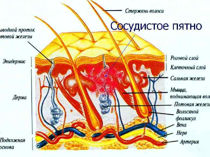 Первичные и вторичные морфологические элементы кожи презентация