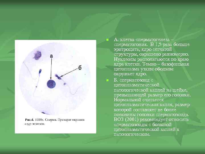n n А. клетка сперматогенеза – сперматогония. В 1, 5 раза больше эритроцита, ядро