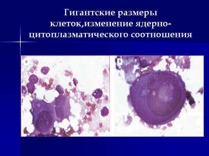 Гигантские размеры клеток, изменение ядерноцитоплазматического соотношения 