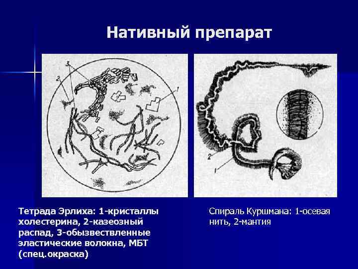 Тетрада эрлиха