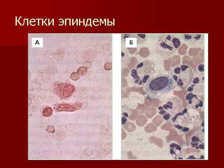 Клетки эпиндемы 