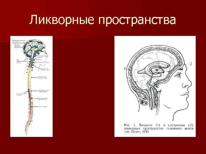 Расширение ликворных пространств