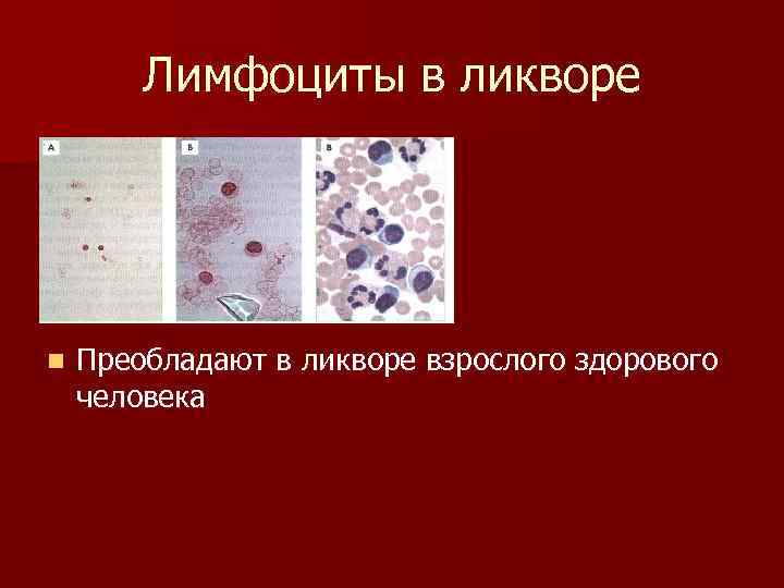 Лимфоциты в ликворе n Преобладают в ликворе взрослого здорового человека 