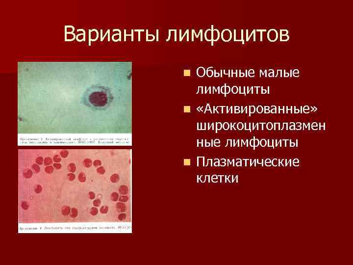 Варианты лимфоцитов Обычные малые лимфоциты n «Активированные» широкоцитоплазмен ные лимфоциты n Плазматические клетки n
