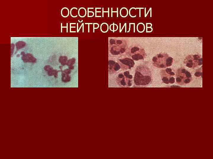 ОСОБЕННОСТИ НЕЙТРОФИЛОВ 