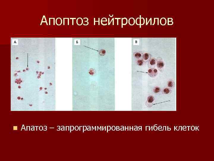 Апоптоз нейтрофилов n Апатоз – запрограммированная гибель клеток 