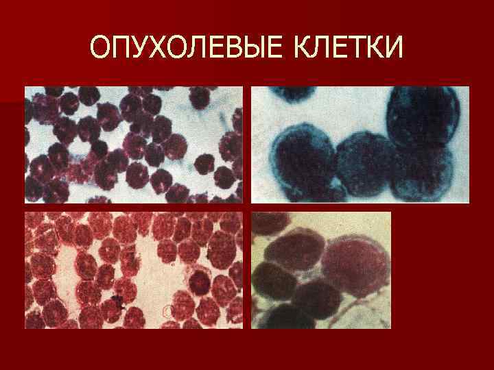 ОПУХОЛЕВЫЕ КЛЕТКИ 