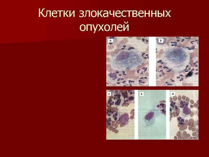 Клетки злокачественных опухолей 