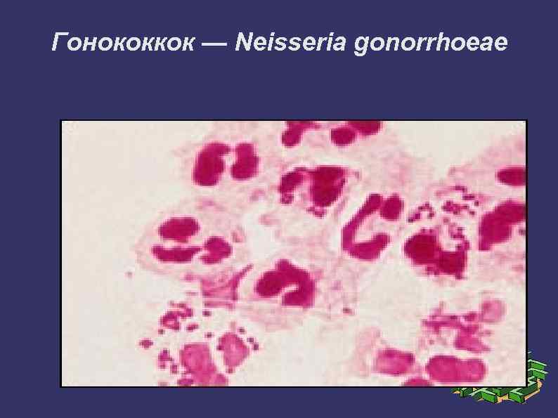 Гонококкок — Neisseria gonorrhoeae 