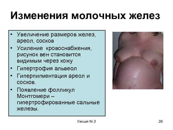 Изменения молочных желез • Увеличение размеров желез, ареол, сосков • Усиление кровоснабжения, рисунок вен