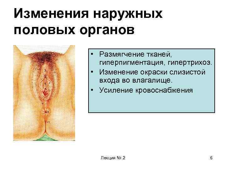 Изменения наружных половых органов • Размягчение тканей, гиперпигментация, гипертрихоз. • Изменение окраски слизистой входа