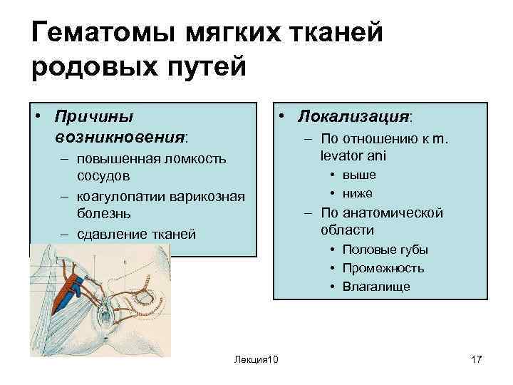 После родов полово. Гематомы мягких тканей родовых путей. Гематомы мягких родовых путей возникают. Гематома мягкихтканей родовыхпу ей. Гематомы мягких тканей родовых путей причины.