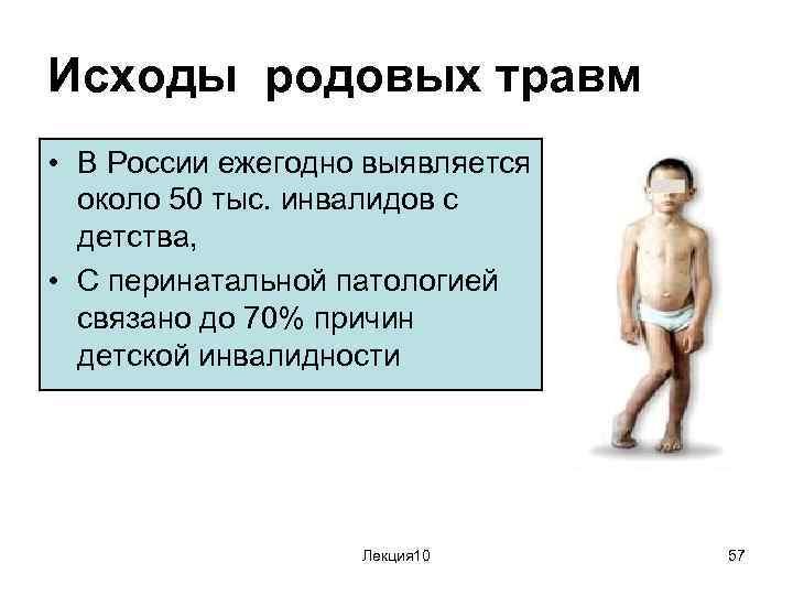 Исходы родовых травм • В России ежегодно выявляется около 50 тыс. инвалидов с детства,