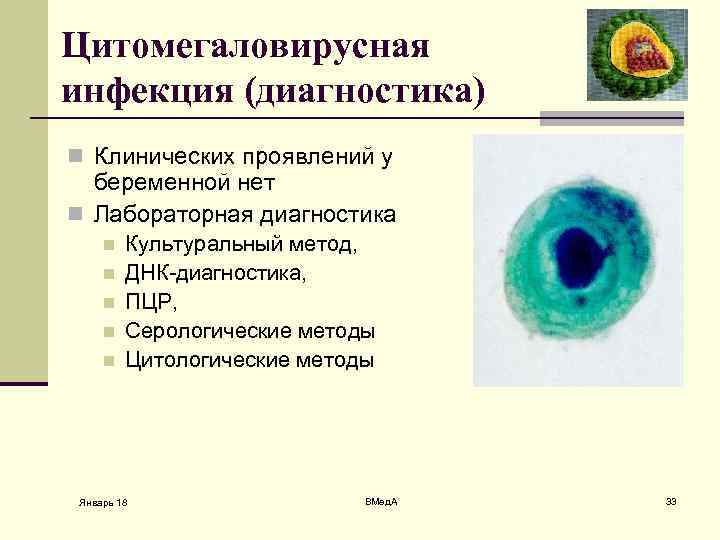 Цитомегаловирусная инфекция (диагностика) n Клинических проявлений у беременной нет n Лабораторная диагностика n n