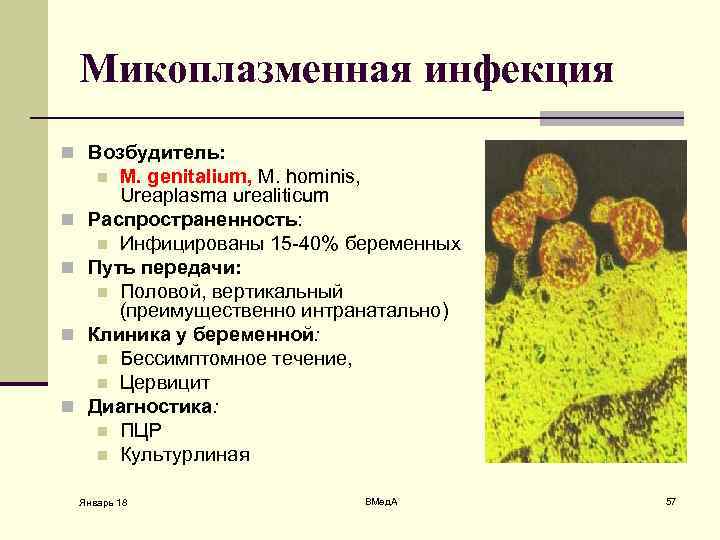 Микоплазменная инфекция n Возбудитель: M. genitalium, M. hominis, Ureaplasma urealiticum Распространенность: n Инфицированы 15