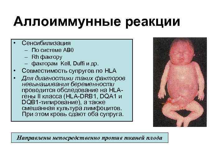 Аллоиммунные реакции • Сенсибилизация – По системе АВ 0 – Rh фактору – факторам
