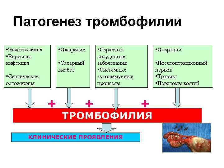 Тромбофилия клиническая картина