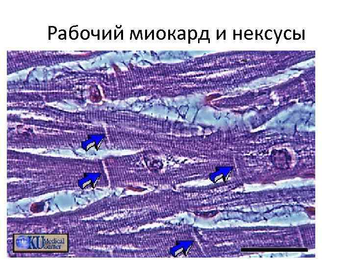 Рабочий миокард и нексусы 