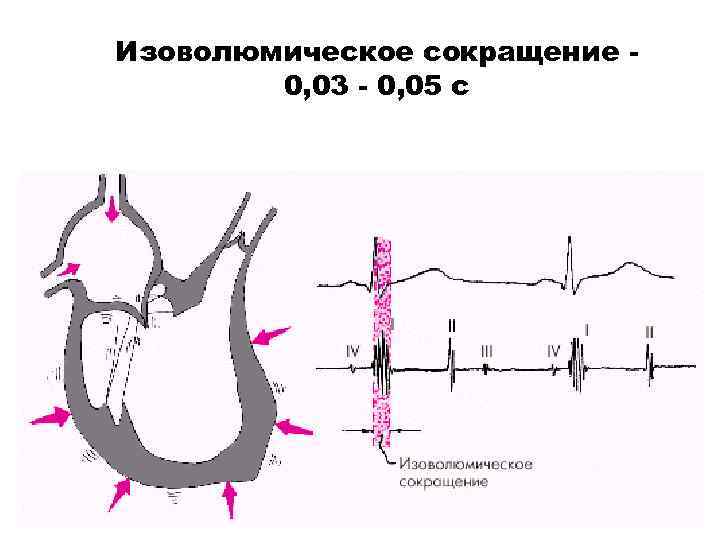 Изоволюмическое сокращение 0, 03 - 0, 05 с 