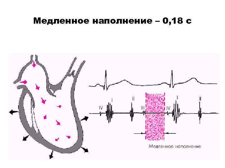 Медленное наполнение – 0, 18 с 