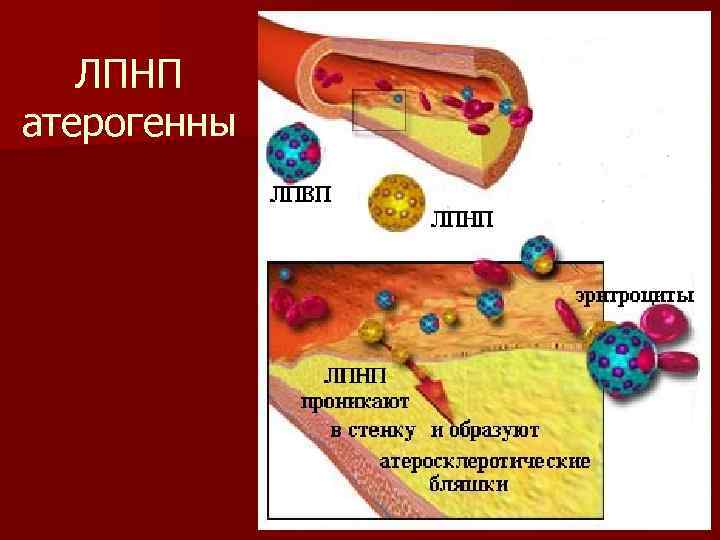 ЛПНП атерогенны 