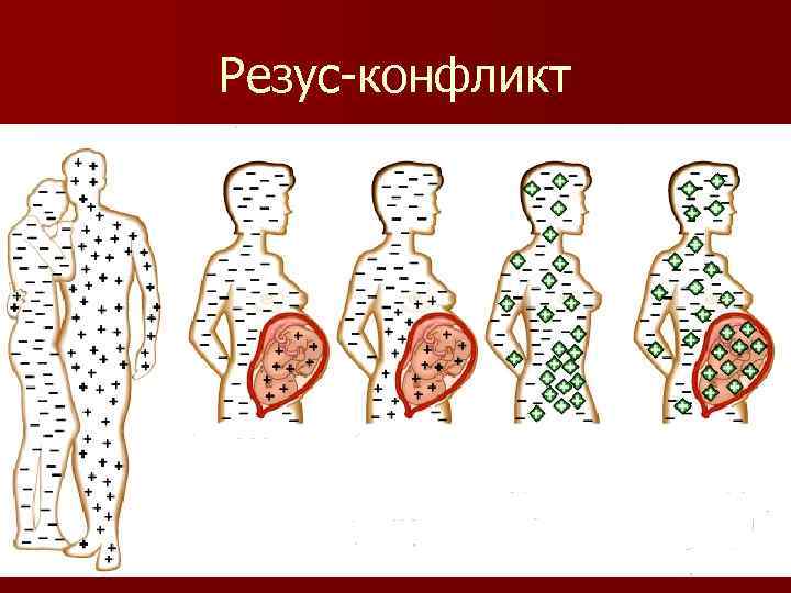 Резус-конфликт 