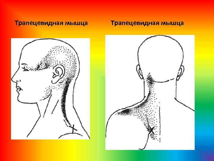 Трапецевидная мышца 