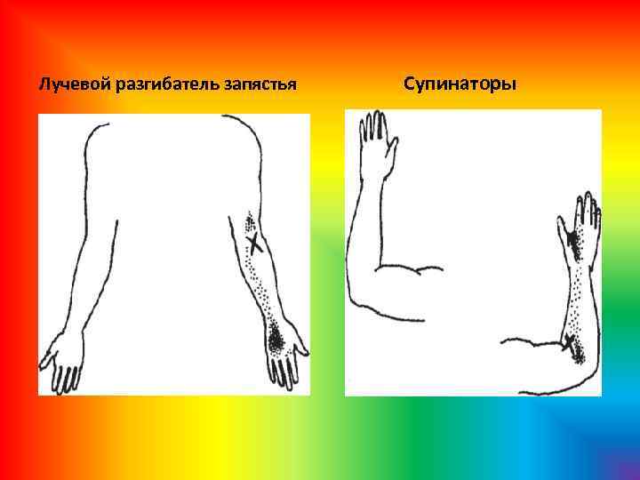 Лучевой разгибатель запястья Супинаторы 