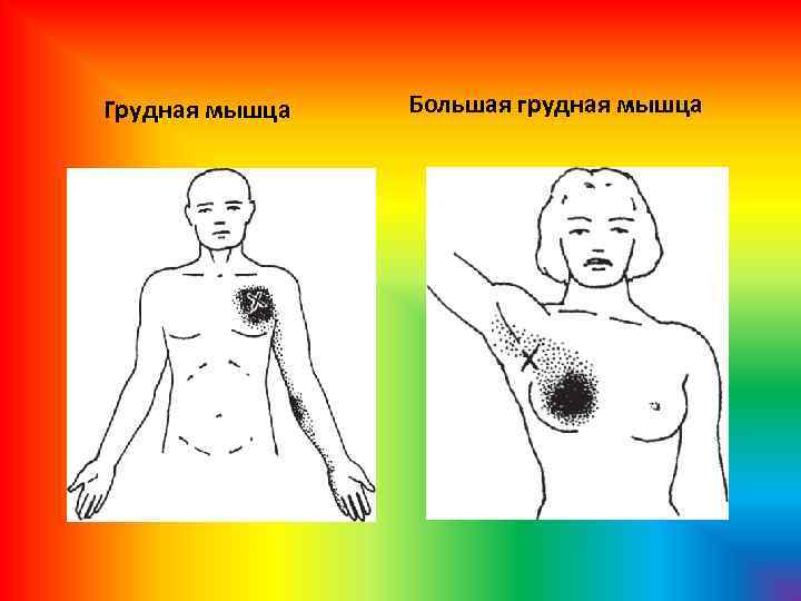  Грудная мышца Большая грудная мышца 