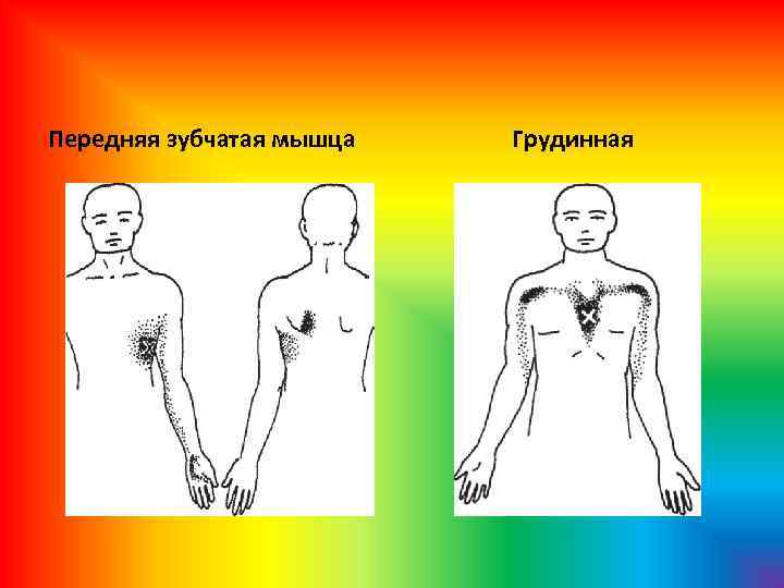 Передняя зубчатая мышца Грудинная 
