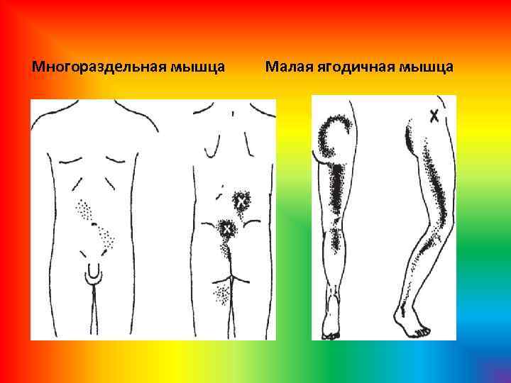 Многораздельная мышца Малая ягодичная мышца 