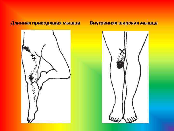 Длинная приводящая мышца Внутренняя широкая мышца 