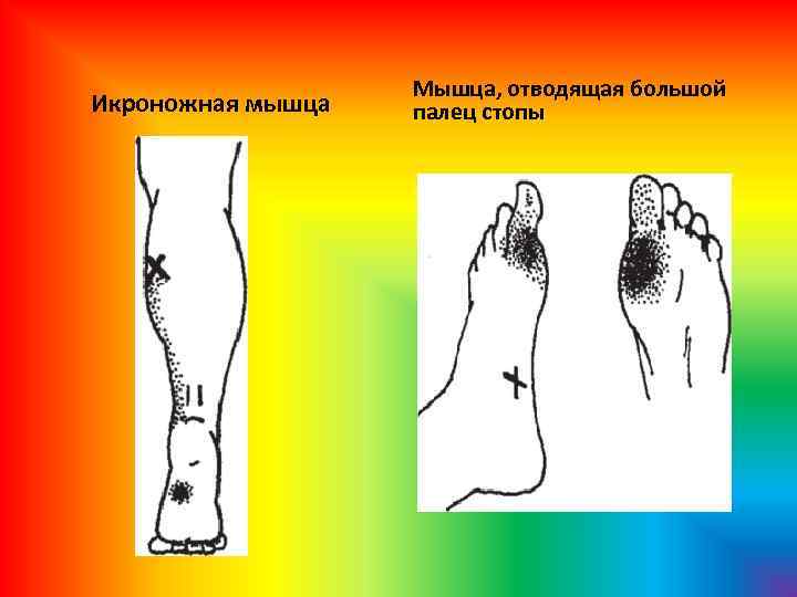  Икроножная мышца Мышца, отводящая большой палец стопы 